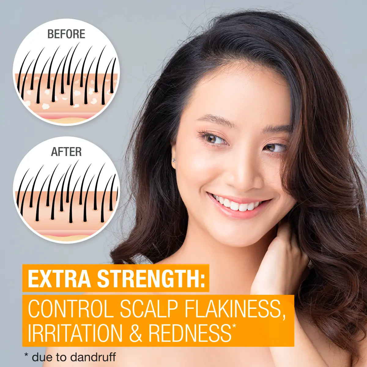 Neutrogena® Scalp Therapy Anti-dandruff Extra Strength - US 4484