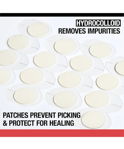 Neutrogena Stubborn Acne® Ultra-Thin Blemish Patches - 16 Ct Patches - US 2409
